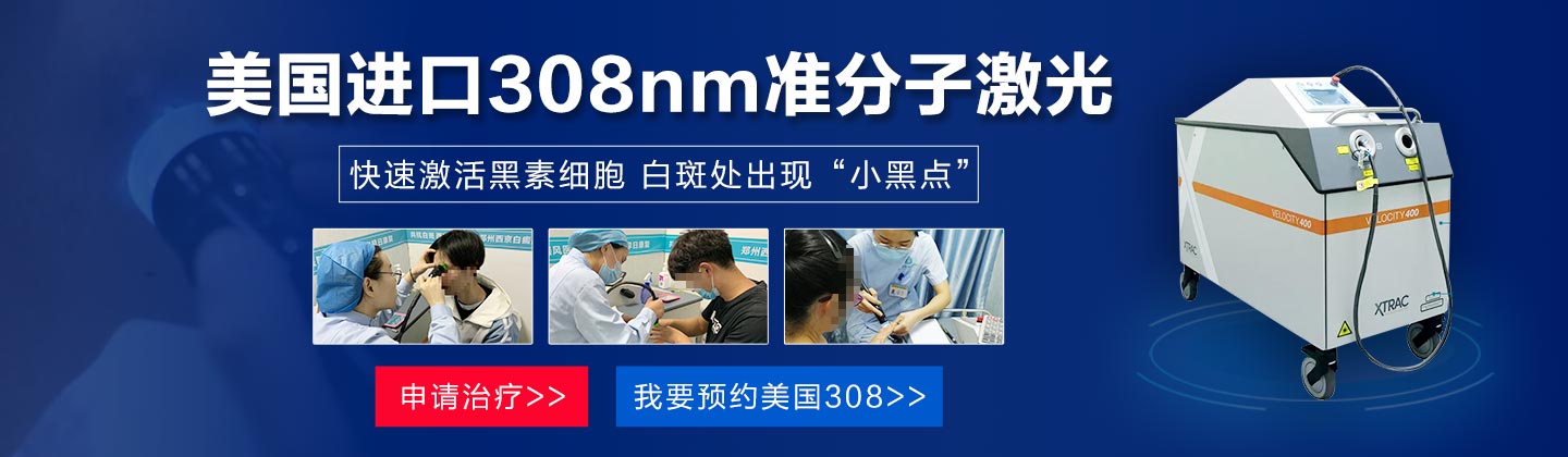 郑州西京308激光